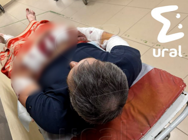 В Перми стаффорды напали на мужчину: владелец требует доказательства вины собак - ВЕДОМОСТИ Урал - Новости Екатеринбурга и Свердловской области сегодня