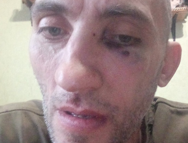 В Нижнем Тагиле группа подростков жестоко избила общественника Максима Емельянова - ВЕДОМОСТИ Урал - Новости Екатеринбурга и Свердловской области сегодня