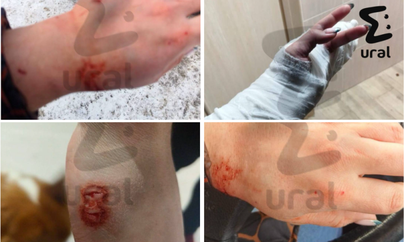 Кровавый оскал ротвейлера: в Екатеринбурге мать защитила сына от пса ценой собственного здоровья - ВЕДОМОСТИ Урал - Новости Екатеринбурга и Свердловской области сегодня