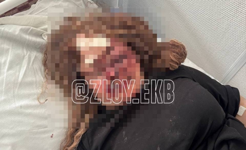 В Екатеринбурге возле бара на Сортировке избили женщину – виновные на свободе - Новости Свердловской области — последние события в Екатеринбурге и области