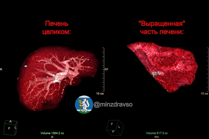 � ������������� ��������� ����� ������ ��� ���������� �������� - ��������� ����