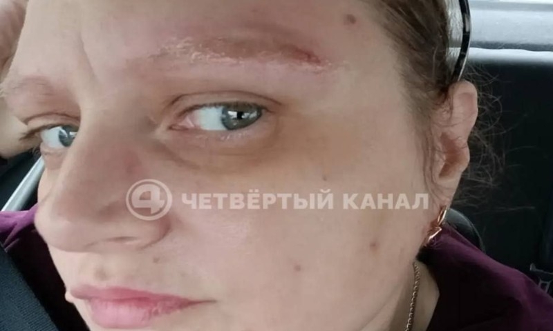 �������� ������� ���������� ��� ���������������� ������� � ������ � 165 ����� - ��������� ����